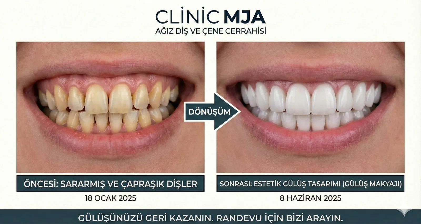 Ästhetische Zahnheilkunde & Smile Design