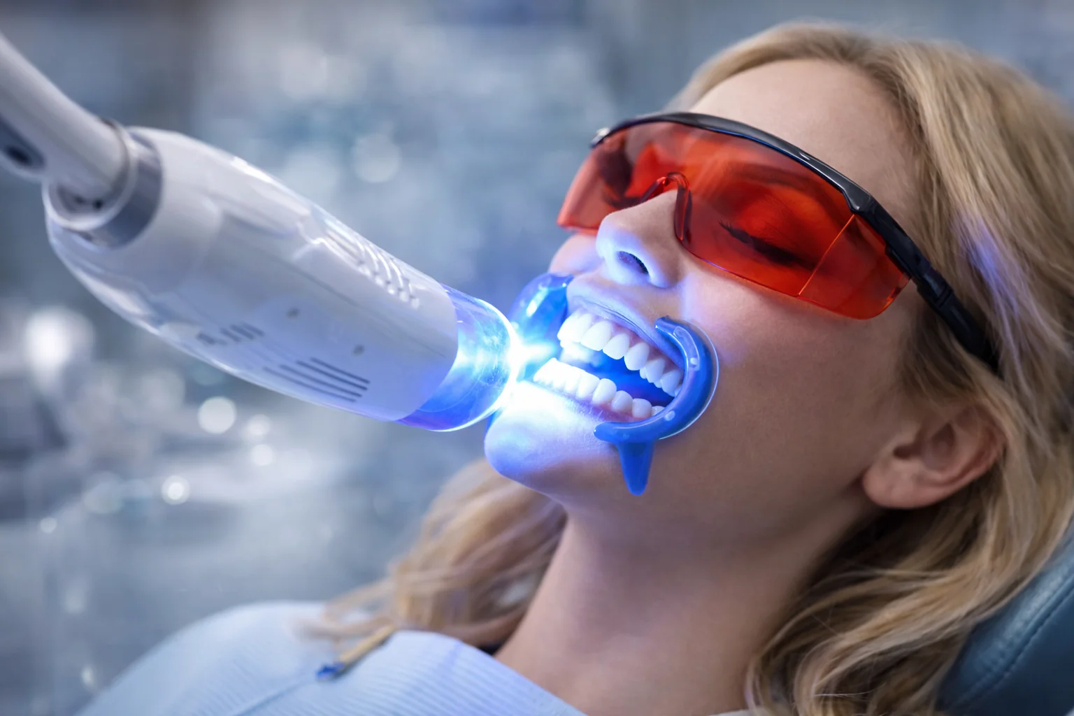 Professionelle Zahnaufhellung (Bleaching)